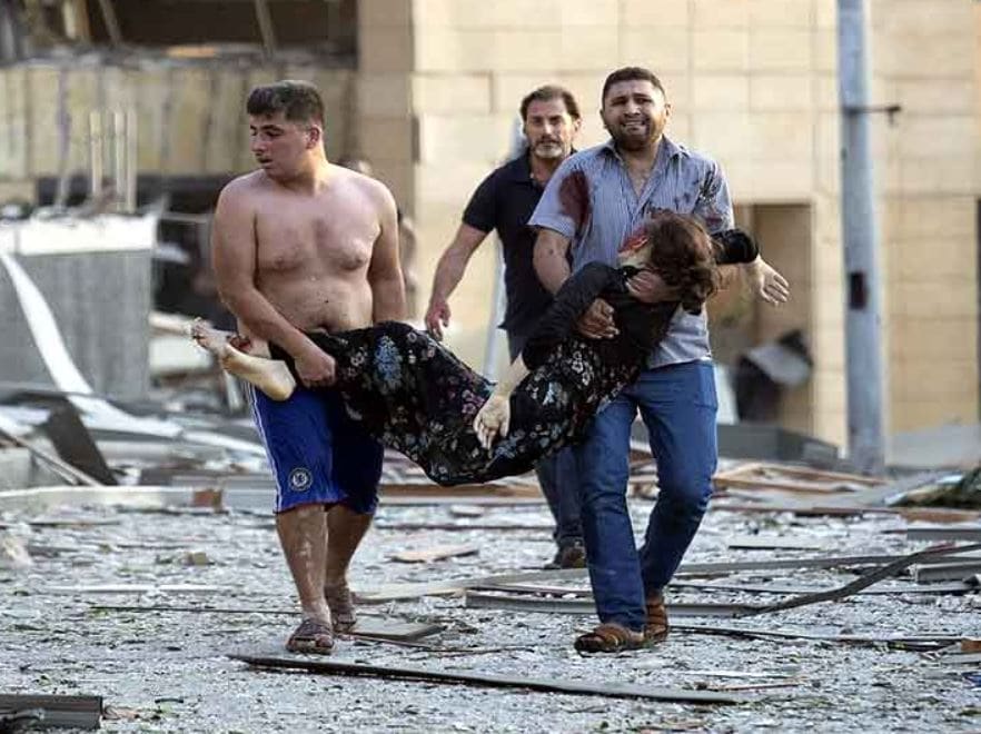 स्कूटी पर घायल को लेकर अस्पताल पहुंचा युवक, देखें बेरूत धमाके का मंजर