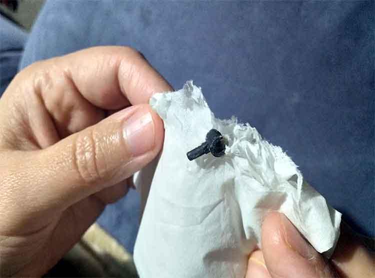 2 साल पहले नाक में फंसी थी ये चीज, केक खाते समय छींका तो निकली