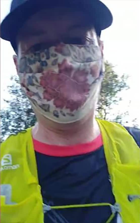 मास्क से नहीं घुटता दम, साबित करने के लिए 35 KM दौड़ा डॉक्टर