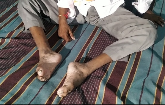 अयोध्या: 1992 में कारसेवा में हुआ था दिव्यांग, भूमिपूजन में जाने की चाहत