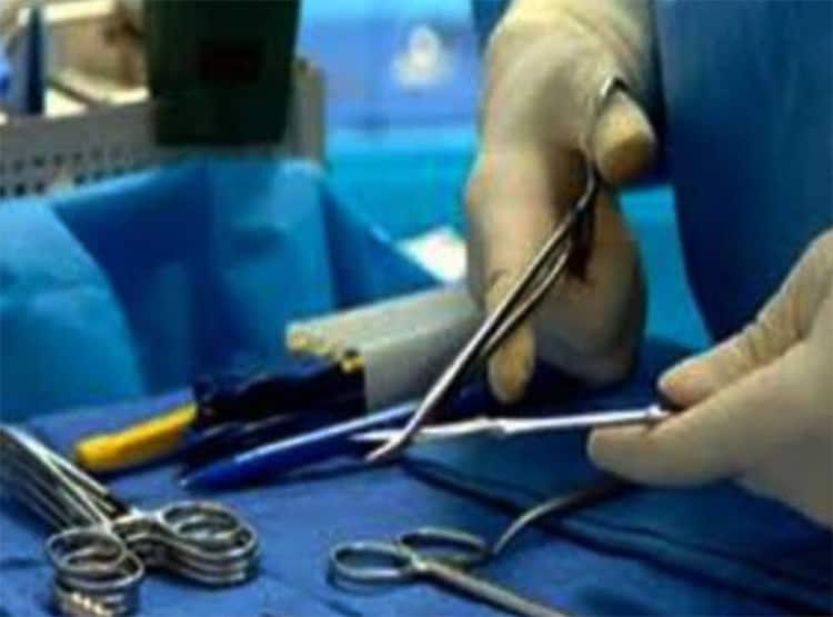 महिला के पेट से निकला 24 किलो का ट्यूमर, डॉक्टर भी हैरान