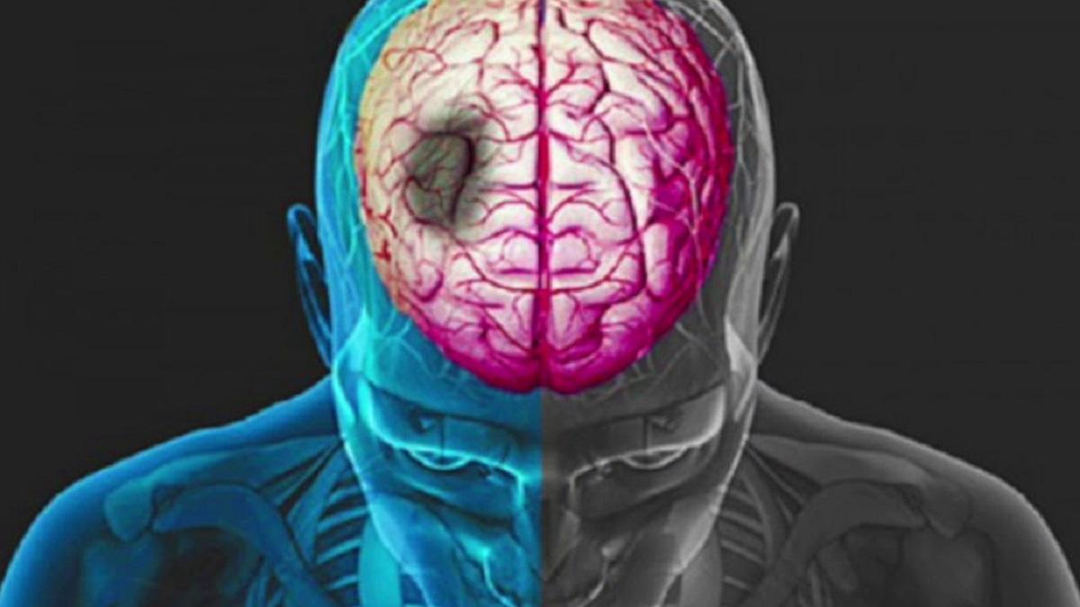 इंसान के दिमाग पर कैसे अटैक कर रहा कोरोना? 