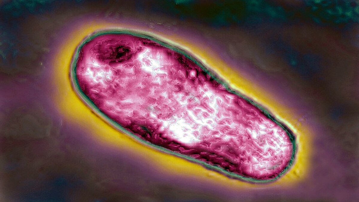 3000 people test positive for Brucellosis in China