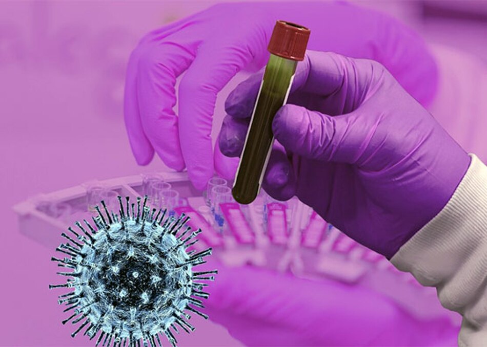 एंटीबॉडी का स्तर