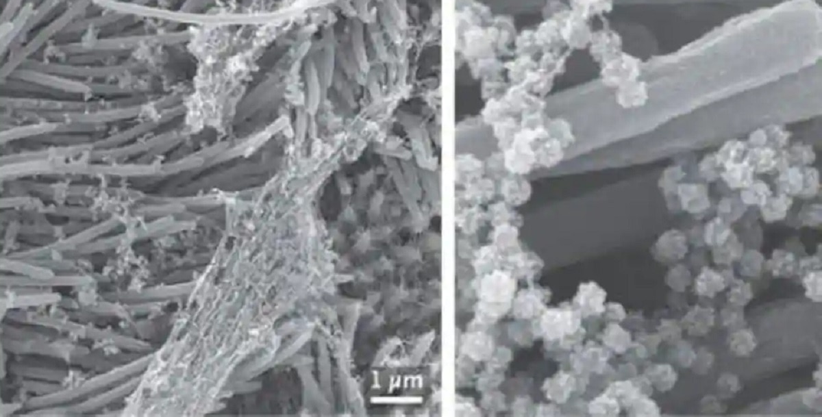 कोरोना से संक्रमित कोशिकाओं की तस्वीरें सामने आईं