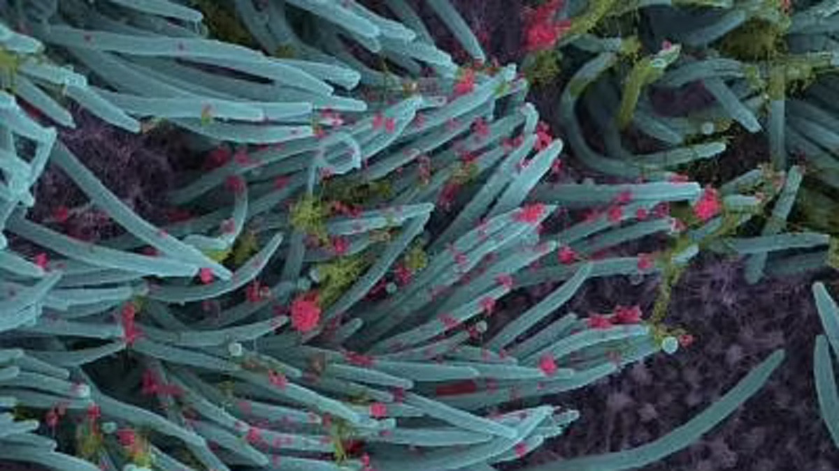 कोरोना से संक्रमित कोशिकाओं की तस्वीरें सामने आईं