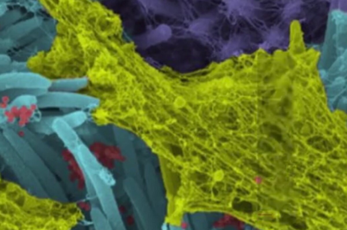 कोरोना से संक्रमित कोशिकाओं की तस्वीरें सामने आईं