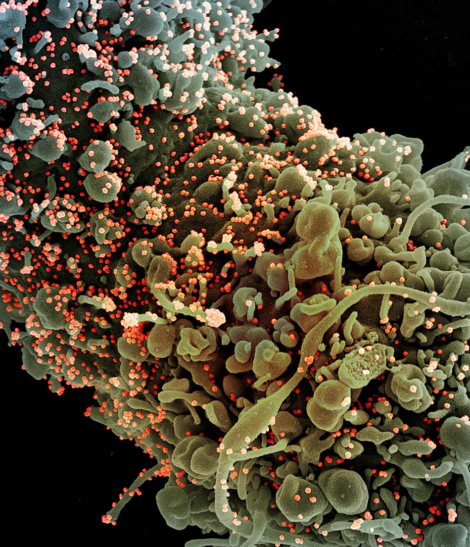 Coronavirus