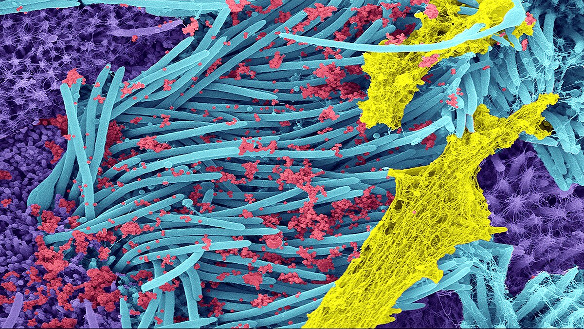 Chinese Virologist Dr. Li-Meng Yan Says Covid-19 was made in Wuhan Lab