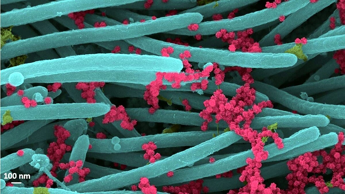 Chinese Virologist Dr. Li-Meng Yan Says Covid-19 was made in Wuhan Lab