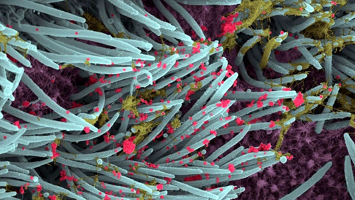 Chinese Virologist Dr. Li-Meng Yan Says Covid-19 was made in Wuhan Lab