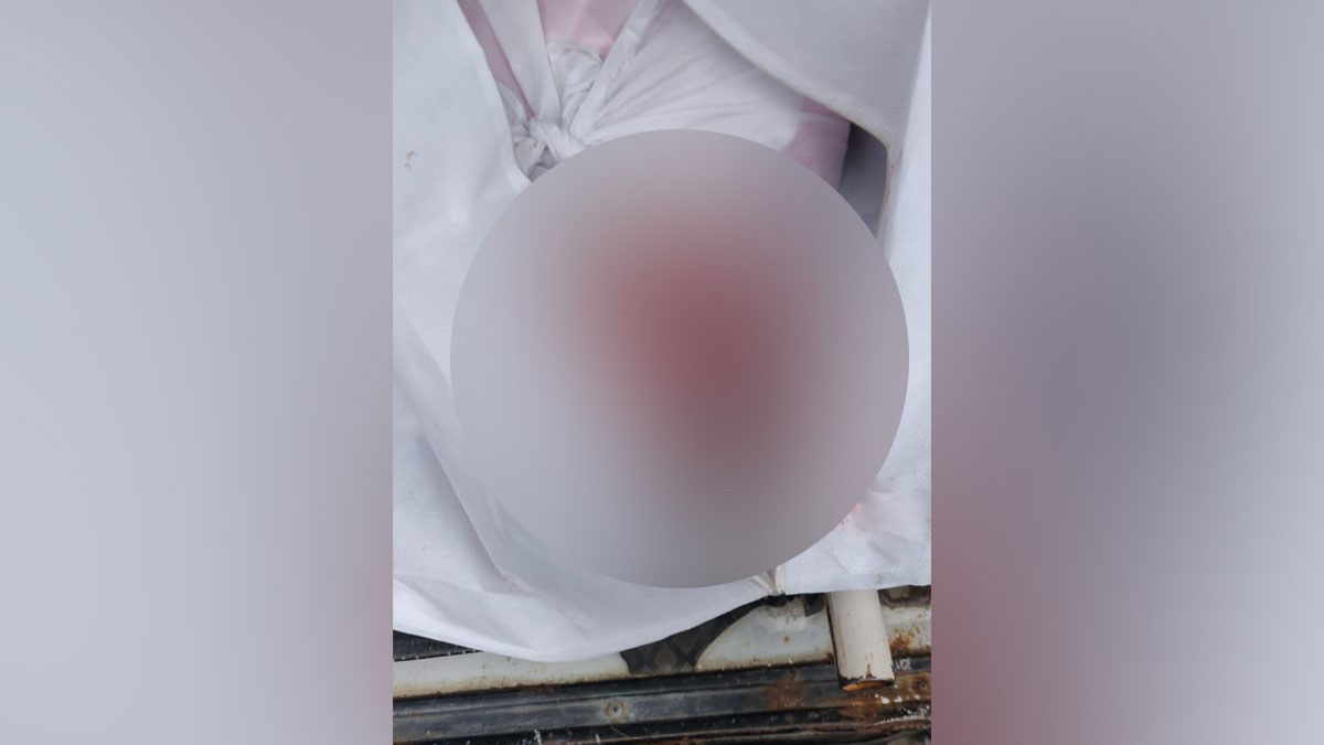 बुजुर्ग के शव को चूहों ने कुतरा (फोटो आजतक)