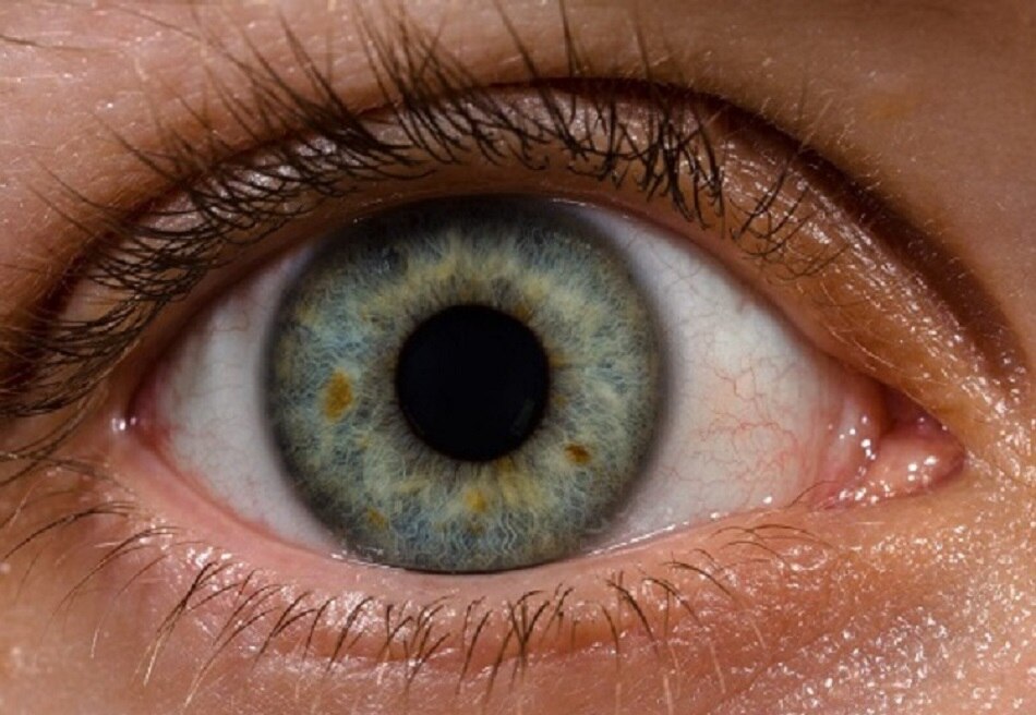 आंखों में धुंधलापन