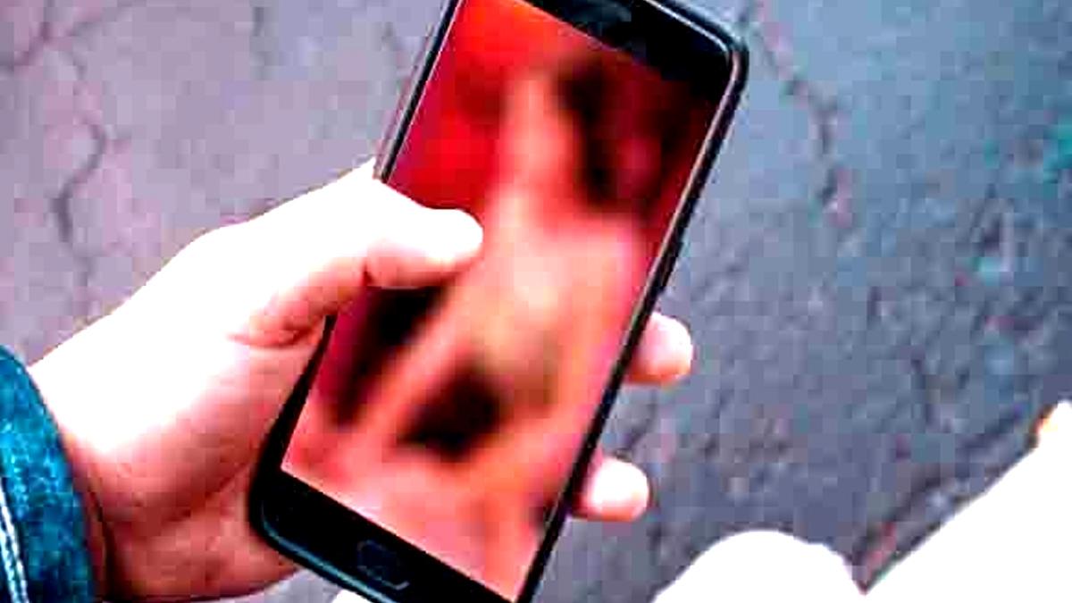 Representative image