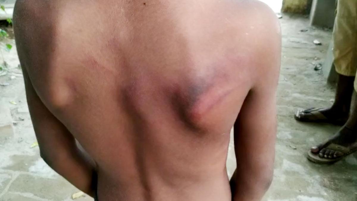  ट्यूशन टीचर ने 8 साल के मासूम को जमकर पीटा (फोटो आजतक)