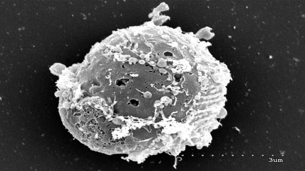 Virus Eating single cell creatures found in Catalonia Spain