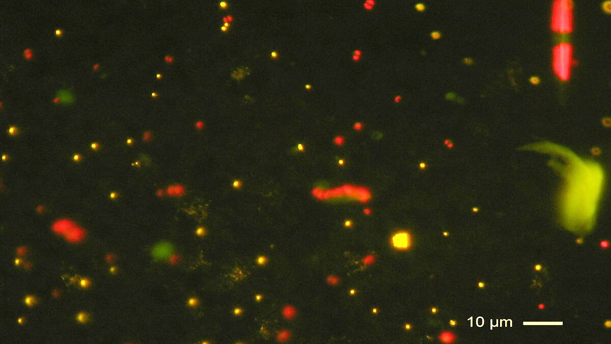 Virus Eating single cell creatures found in Catalonia Spain