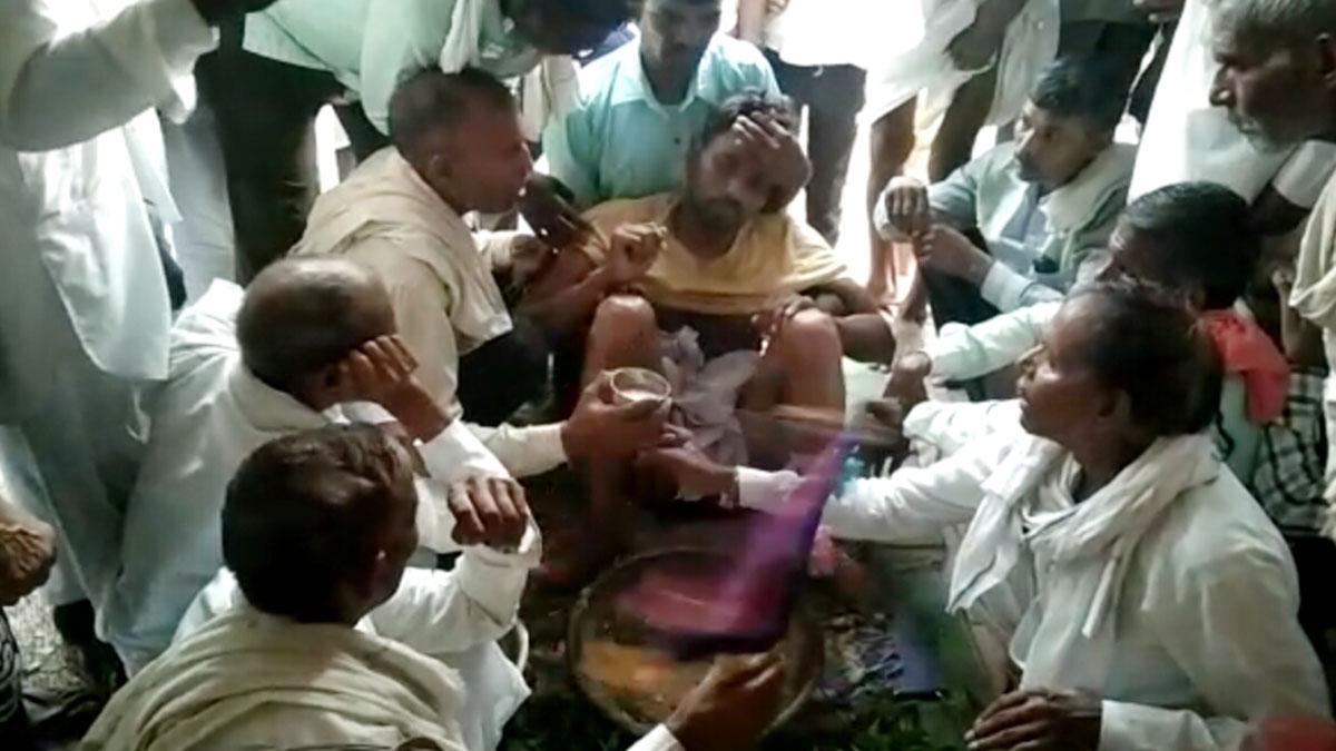 युवक को सांप ने काटा (फोटो आजतक)