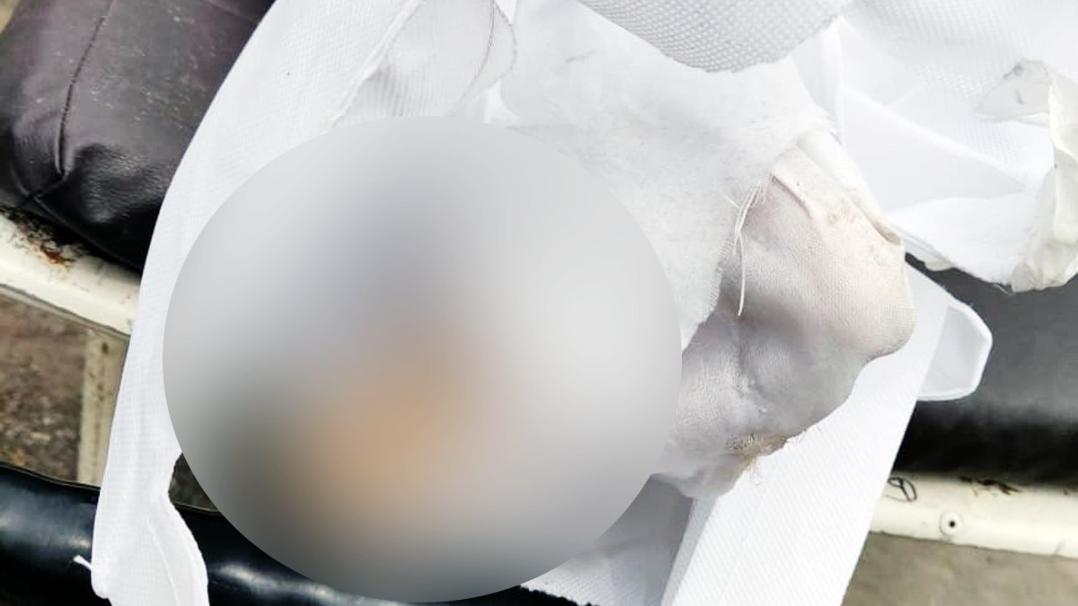 बुजुर्ग के शव चूहों ने कुतर दिया (फोटो आजतक)