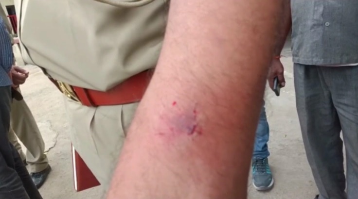 महिला पुलिसकर्मी को पीटा