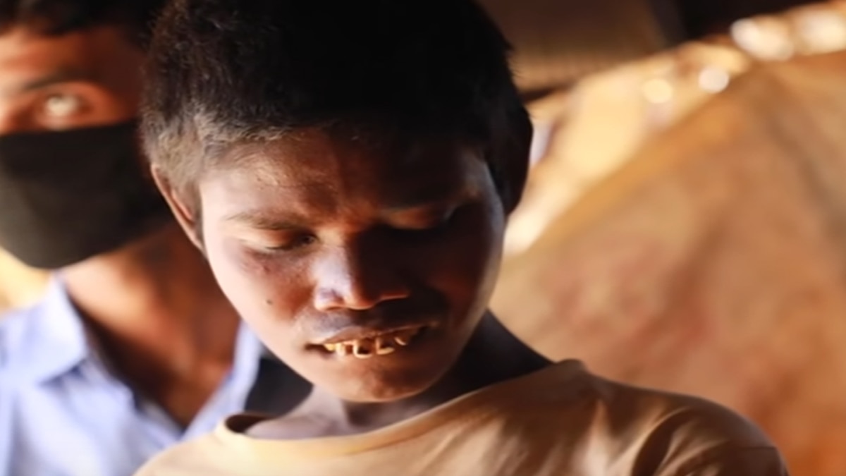 भूपनगर गांव जहां घर-घर दिव्यांग हैं. 