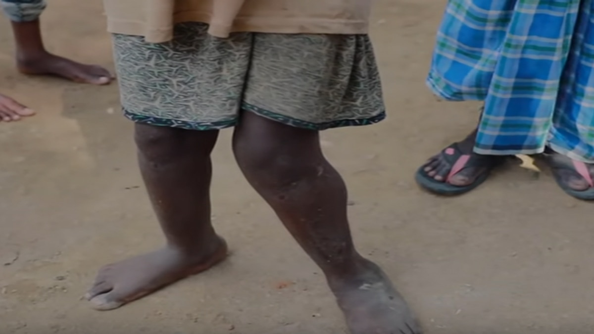 गांव में लोगों के शरीर अकड़े हुए हैं. 