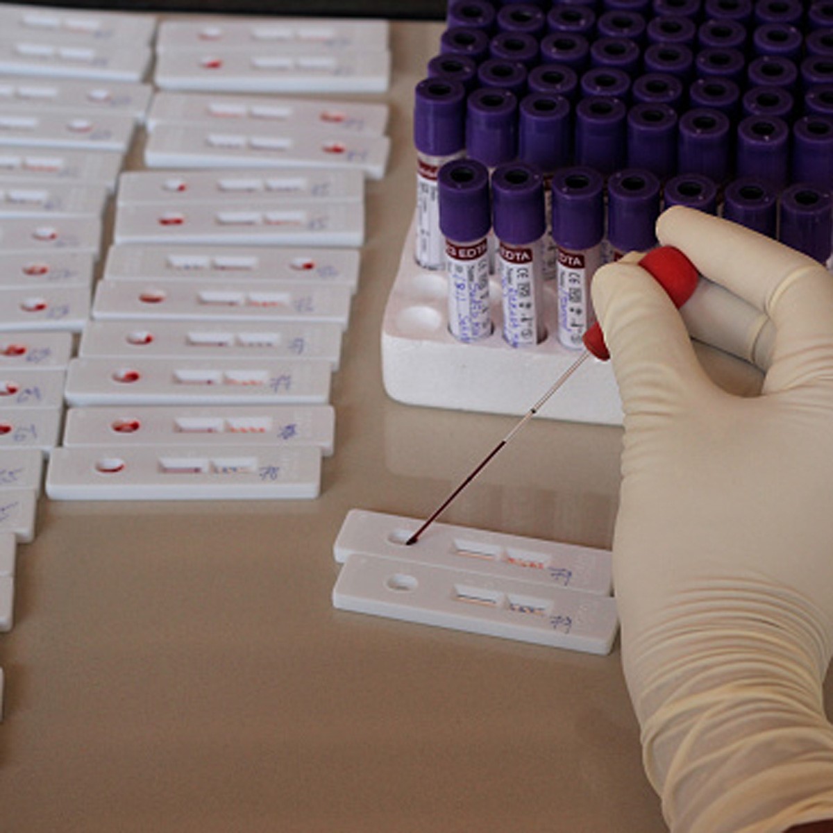 What is FELUDA paper strip test