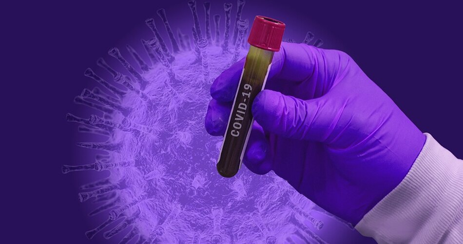 सीमित मात्रा में होगी उपलब्ध