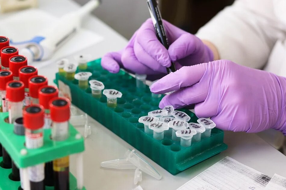 सार्वजनिक स्वास्थ्य पर दें ध्यान