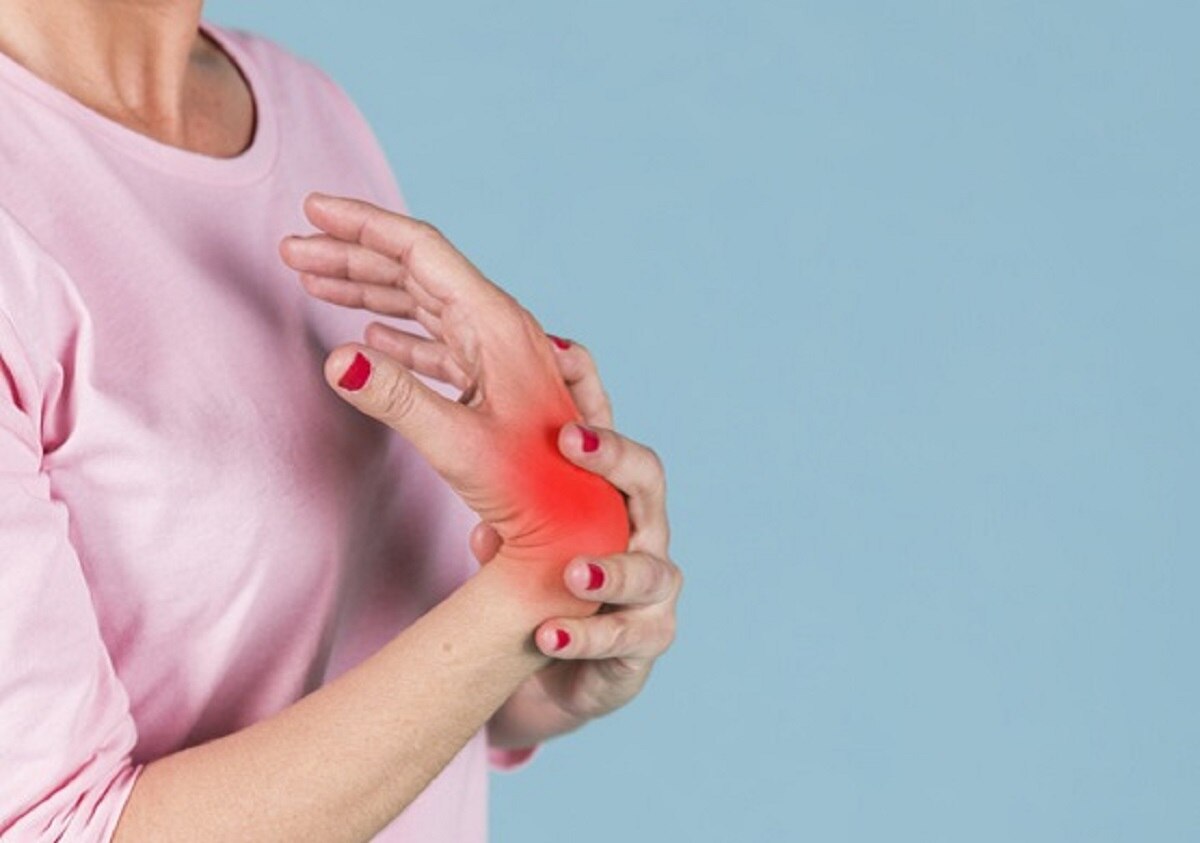 आर्थराइटिस