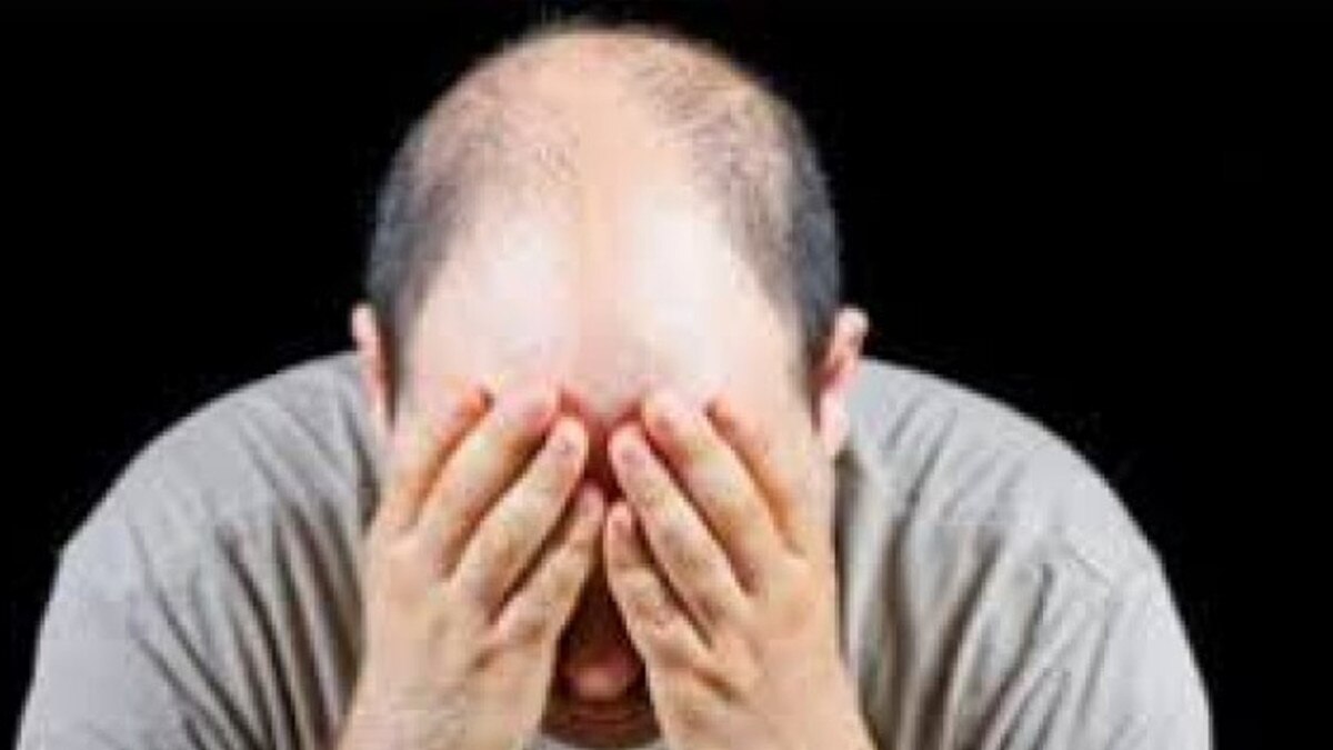 पति गंजा निकला तो नई नवेली सीए दुल्‍हन ने पुलिस में कराया केस दर्ज.