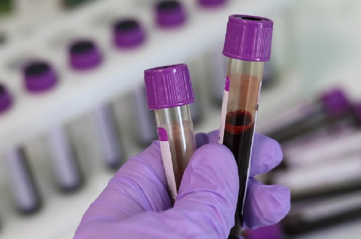 महिलाओं की जिंदगी के 6 साल कम