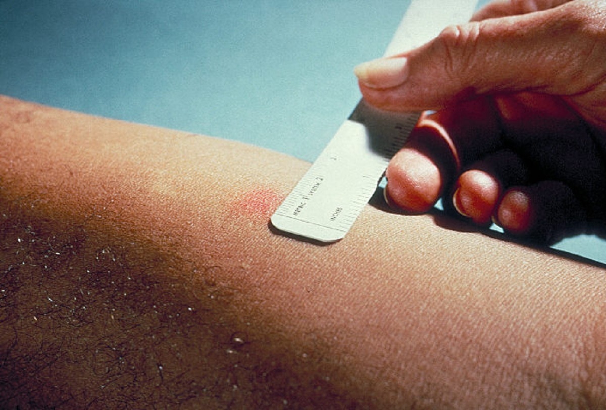 त्वचा में बदलाव