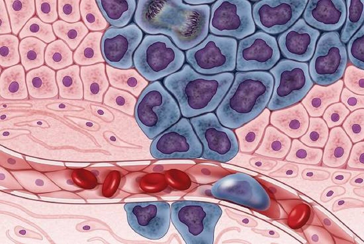 प्रोटीन से खतरा क्यों?