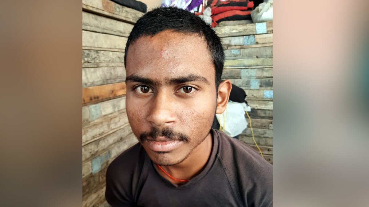 18 महीने से शौच करने नहीं गया लड़का, रोज खा जाता है 18 से 20 रोटी