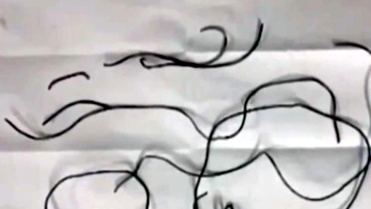 यूरिन का रास्‍ता जानना के लिए बच्‍चे ने किया अजीब काम