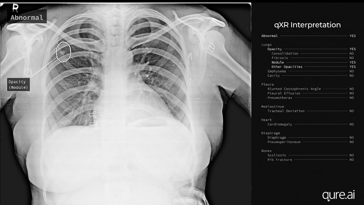 दुनिया के 20 से अधिक देशों में हो रहा इस्तमाल.