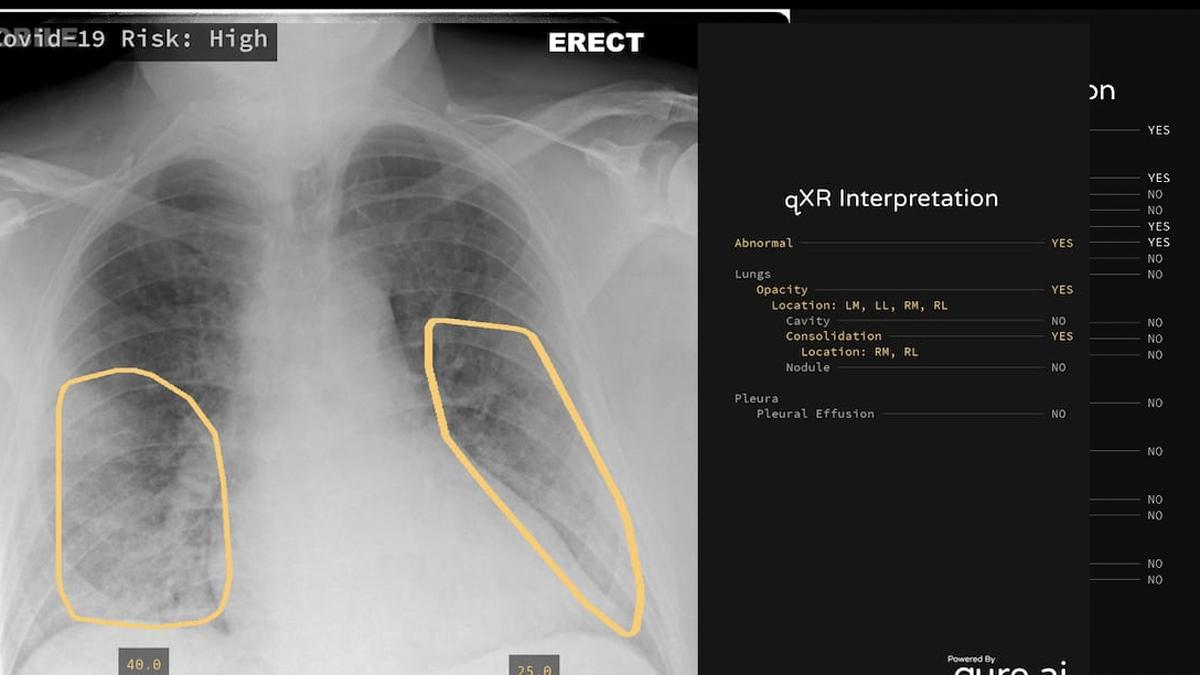झुमरीतिलैया के अंकित की टीम ने बनाया सॉफ्टवेयर.