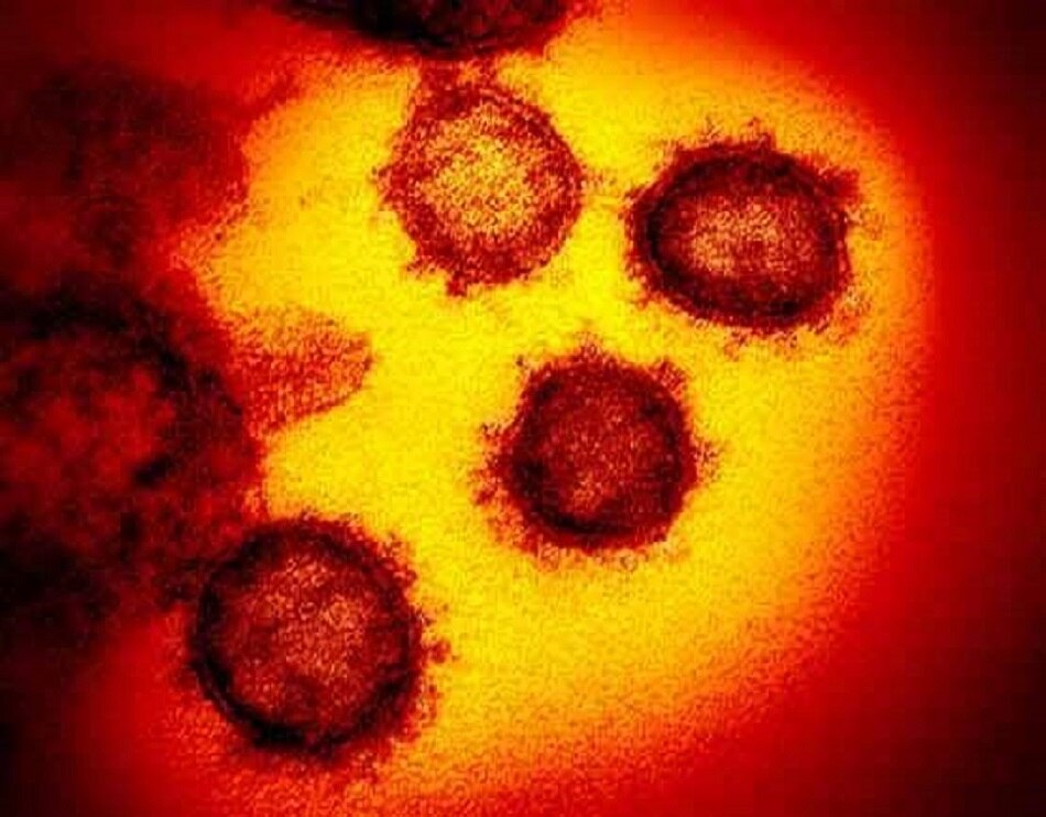 Coronavirus Coronavirus