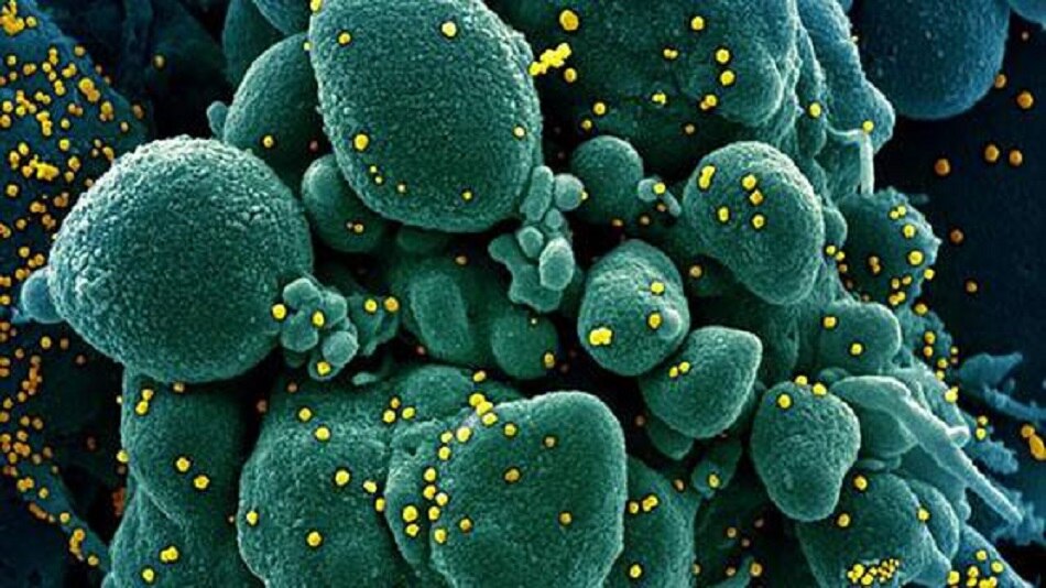 Coronavirus Coronavirus