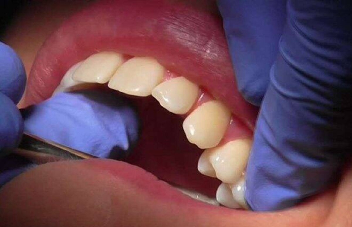 दांतों में दर्द