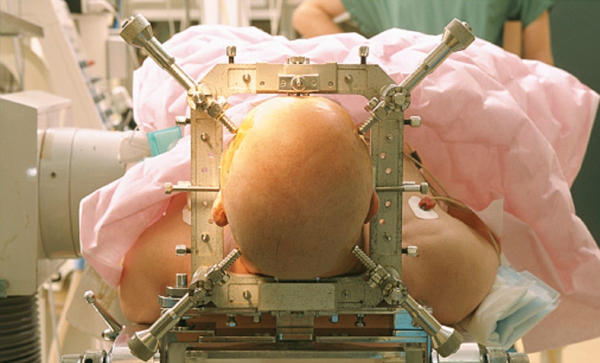 ब्रेन ट्यूमर या अल्जाइमर