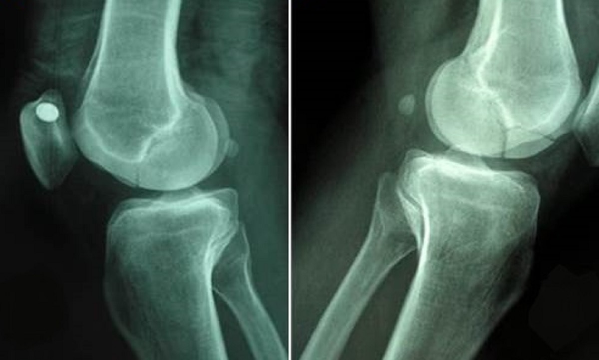 50,000 से ज्यादा लोगों पर शोध