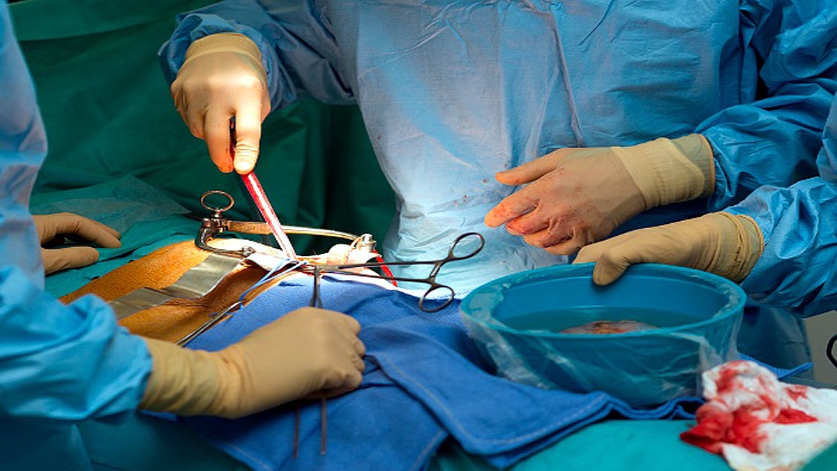 Patna Doctor removed second kidney instead of stone Bihar 