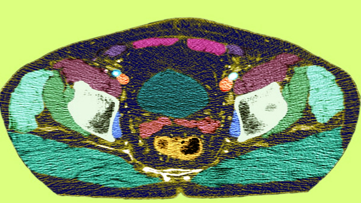 Testicles Pain and Swelling new symptom of Coronavirus