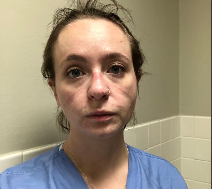 कोरोना वॉरियर्स पर बुरा असर डाल रही ये महामारी