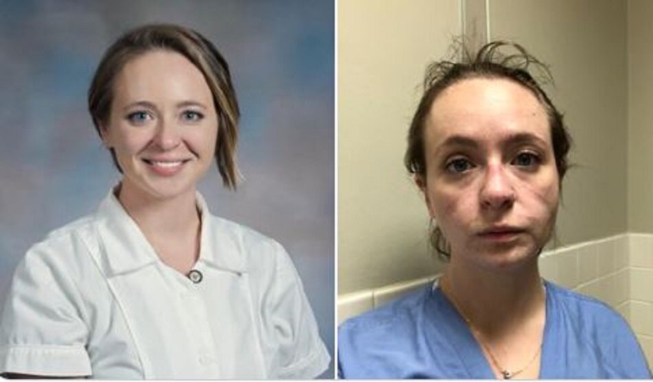 कोरोना वॉरियर्स पर बुरा असर डाल रही ये महामारी