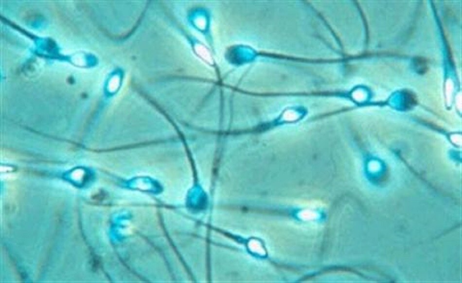 sperm