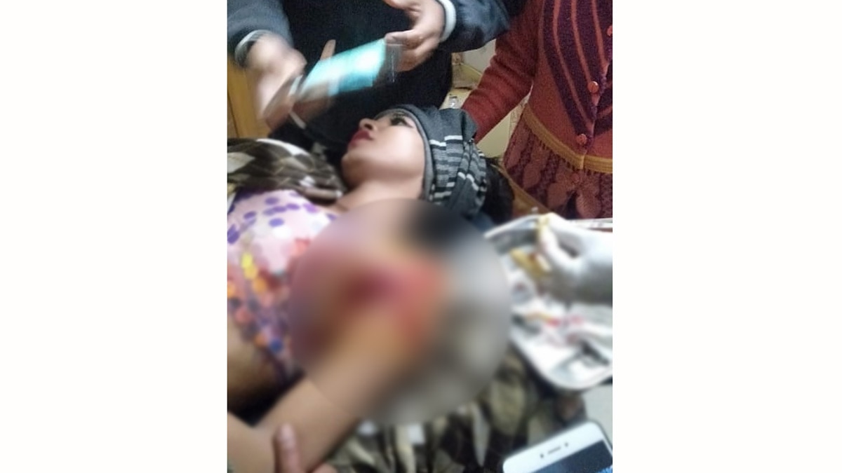 गोली लगने से किन्नर डांसर घायल (फोटो आजतक)