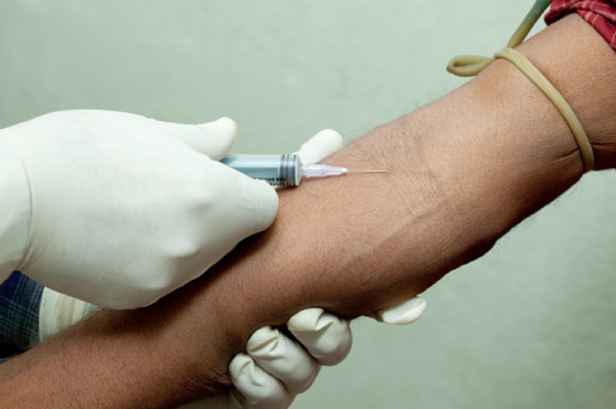 HIV में इम्यून का रिस्पॉन्स